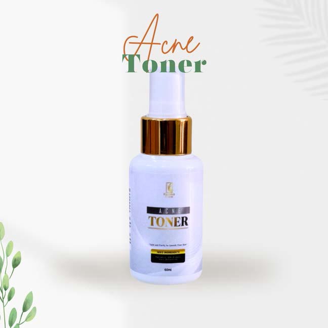 Acne Toner